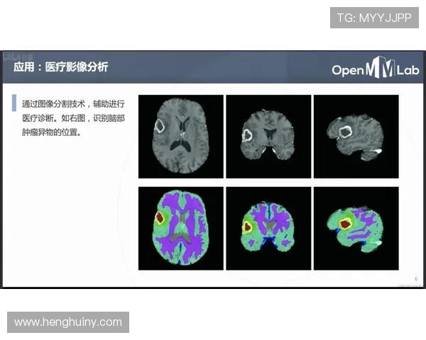深圳乒乓球队包夹战术解析与实战应用探讨